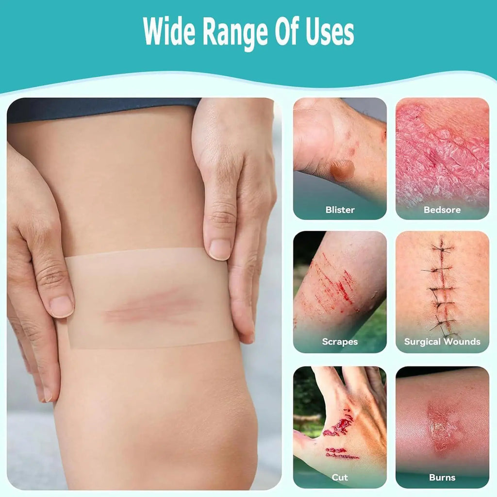 Hydrocolloid Roll Waterproof Pimple Patches Absorbent breathable Gentle Flexible Tape Adhesive Dressing for Burn Pimple Daily
