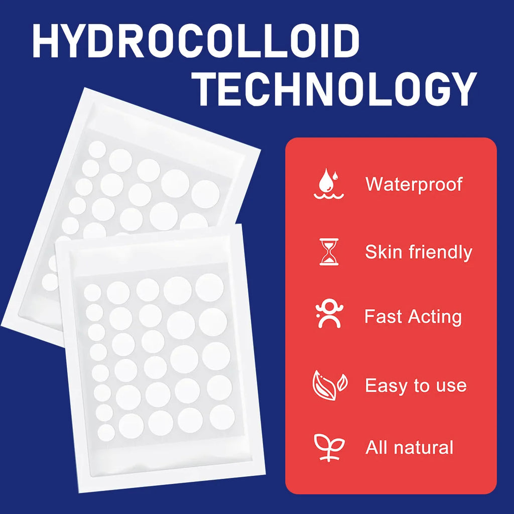 78pcs/set Pimple Patches - Day And Night 2 Sizes 78 Patches Hydrocolloid Acne Pimple Covering Patches With Hyaluronic Acid, Tea