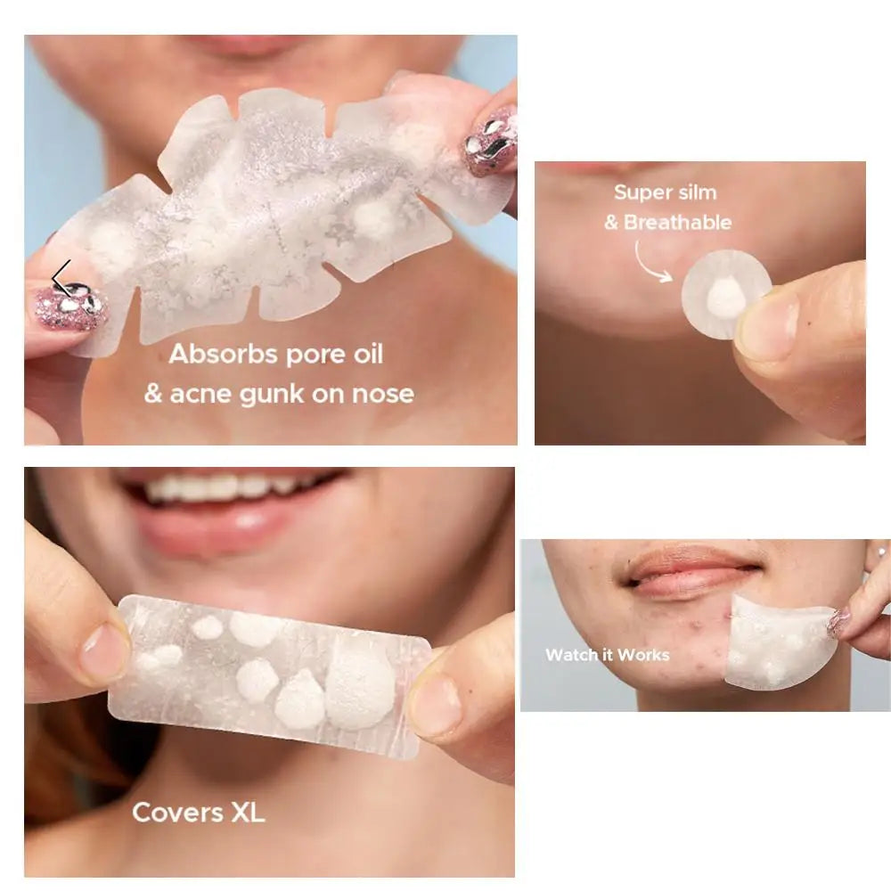 Large Pimple Patches for Face, Big Hydrocolloid Acne Patches for Body, Forehead, Chin, Zit Breakouts (Strip, Contoured, Dots)