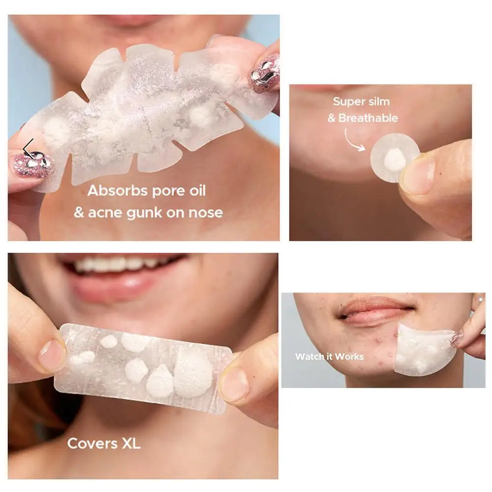 Hydrocolloid Acne Patches Pimple Patches for Face 264pcs Round Shape Spot Stickers Zit Covers for Women