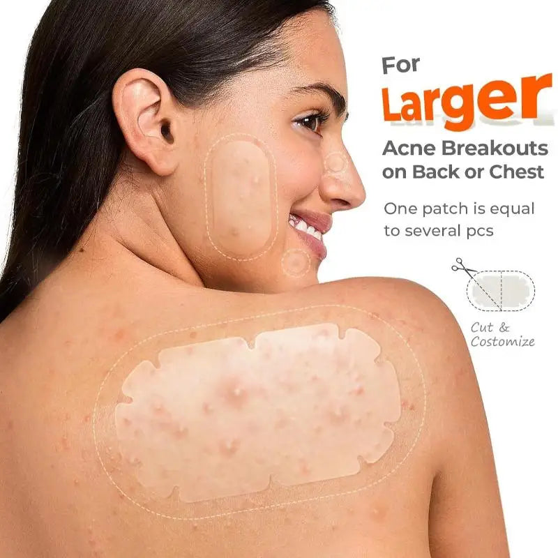 Large Pimple Patches Bulk For Face Hydrocolloid Multi-shape Invisible Removal Acne Patches Covering Body Forehead Chin Blemishes