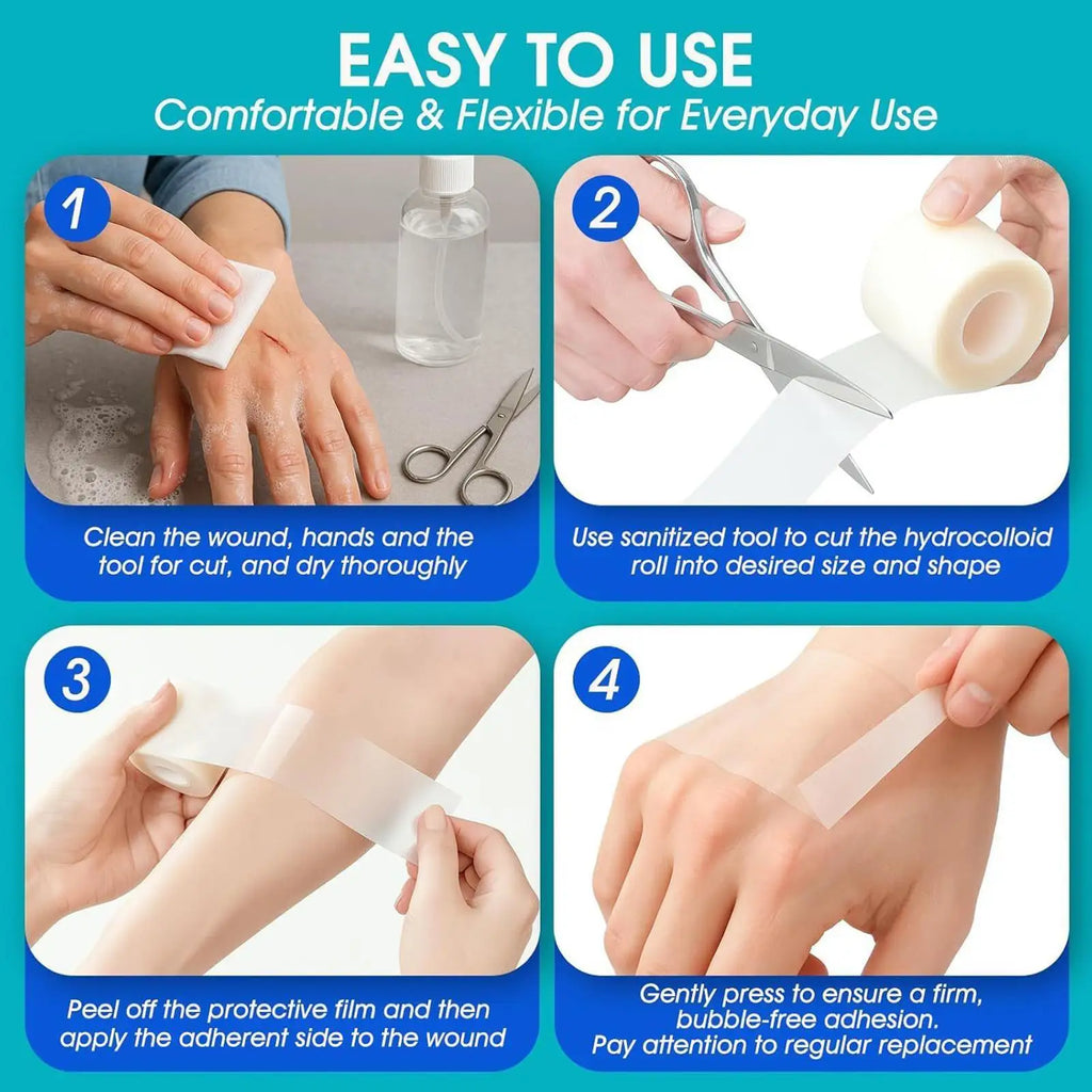 Hydrocolloid Roll Waterproof Pimple Patches Absorbent breathable Gentle Flexible Tape Adhesive Dressing for Burn Pimple Daily
